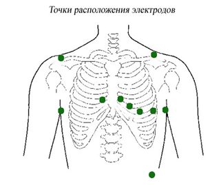 ТОЧКИ РАСПОЛОЖЕНИЯ ЭЛЕКТРОДОВ.png ТОЧКИ РАСПОЛОЖЕНИЯ ЭЛЕКТРОДОВ.png